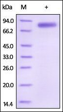 Human IL-12B / NKSF2 / p40 Protein