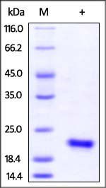Human IL-17F Protein, His Tag