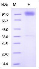 Human IL-18 R1 Protein, Fc Tag