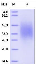 Human IL-18BP Protein, His Tag