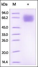 Human IL-18BP Protein