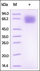 Human IL-18BP Protein, Fc Tag