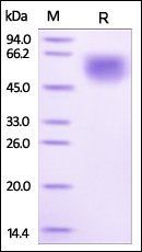 Human IL-1RL1 Protein, His Tag