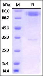 Human IL-1RL1 / ST2 Protein