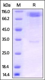 Human IL-1RL1 Protein, Fc Tag