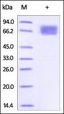 Human IL-2 R alpha / CD25 Protein