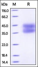 Human IL-2 R alpha / CD25 Protein