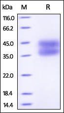 Human IL-2 R alpha Protein, His Tag