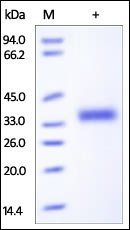 Human IL-2 R beta Protein, His Tag
