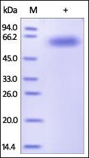 Human IL-2 R beta / CD122 Protein