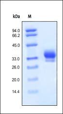 Human IL-29 / IFN-lambda 1 Protein