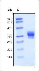 Human IL-29 Protein, His Tag