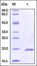 Human IL-37 Protein, His Tag