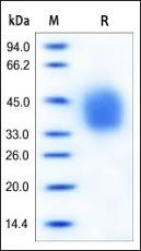 Human IL-4 R alpha Protein, His Tag