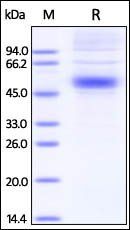 Human IL-5 R alpha Protein, His Tag