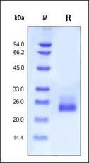 Human IL-6 Protein