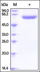 Human LBP / Lipopolysaccharide Protein