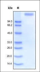 Human Leptin R / CD295 Protein