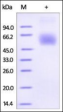 Human Lumican Protein, His Tag