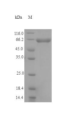 Human MAOM protein (Active)