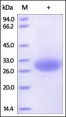 Human Mesothelin / MSLN (37-286) Protein