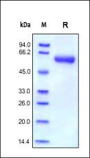 Human MMP-9 Protein, His Tag