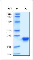 Human Lipocalin-2 Protein, His Tag