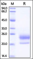 Human Niemann-Pick Type C2 Protein, His Tag