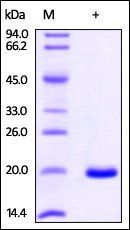 Human NME1 Protein, His Tag