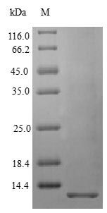 Human NRG1 protein (Active)