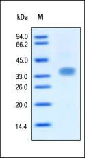 Human Oncostatin M (OSM) Protein