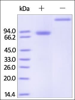 Human Osteoprotegerin / TNFRSF11B Protein