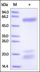 Human Osteopontin (OPN) Protein