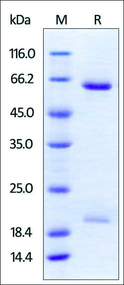 Human PCSK9 Protein, His Tag