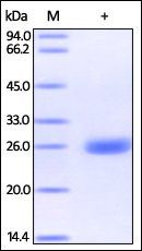 Human UCH-L1 Protein, His Tag