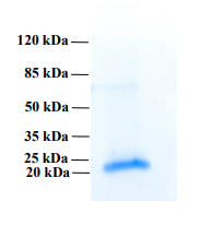 Human PLA2R1 protein