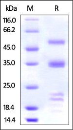 Human PLAU / uPA Protein