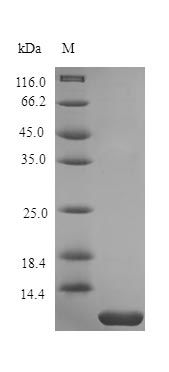 Human PTHY protein (Active)