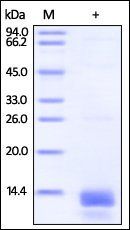 Human S100A14 Protein, His Tag