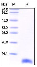 Human S100B Protein, His Tag