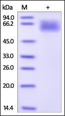 Human Serpin A3 Protein, His Tag