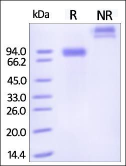 Human Siglec-6 / CD327 Protein