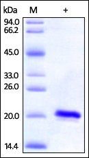 Human SOD1 / Cu-Zn SOD Protein