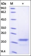 Human Sonic Hedgehog / Shh Protein