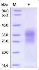 Human SOST / Sclerostin Protein, His Tag