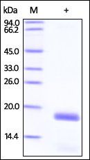 Human Stathmin 1 Protein, His Tag