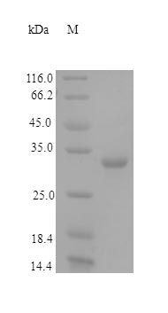Human TIGAR protein (Active)