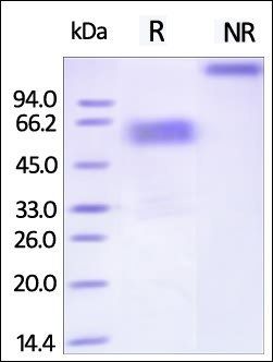 Human TIM-3 / HAVCR2 (22-200) Protein