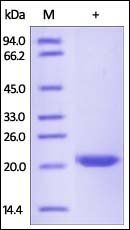 Human TIMP-2 Protein, His Tag