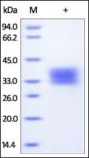 Human TNFR1 Protein, His Tag